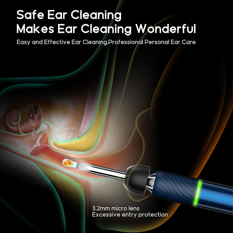 Dispozitiv Curatare Urechi, POKKOSCOPE™, WiFi, Camera HD, Control Inteligent Temperatura, Afisaj LED, 8x Accesorii incluse