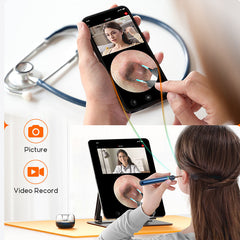 Dispozitiv Curatare Urechi, POKKOSCOPE™, WiFi, Camera HD, Control Inteligent Temperatura, Afisaj LED, 8x Accesorii incluse