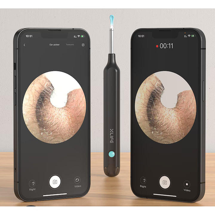 Aparat curatare urechi, Otoscop, POKKOSCOPE™, Camera 3MP, control inteligent temperatura, kit 12 accesorii, LED, negru