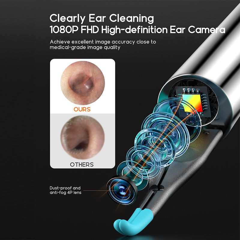 Dispozitiv Curatare Urechi, POKKOSCOPE™, WiFi, Camera HD, Control Inteligent Temperatura, Afisaj LED, 8x Accesorii incluse